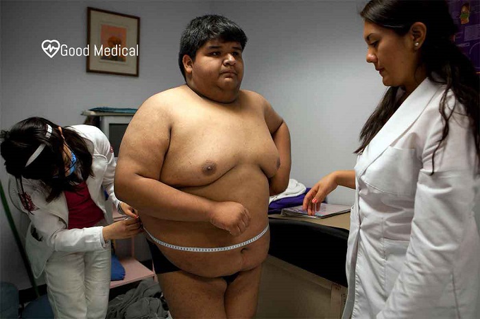 Childhood Obesity – Dealing With an Overweight Kid