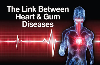Gum disease increases heart disease risk