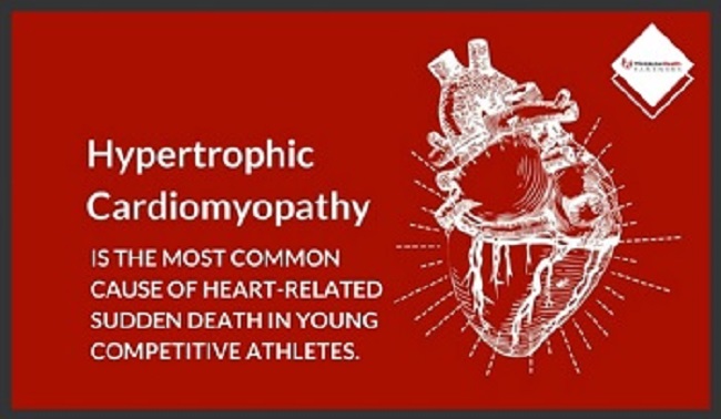 Professor’s Research Could Help Prevent Sudden Cardiac Death of Young Athletes