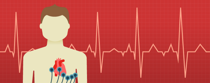 Heart screening: What about young non-athletes?